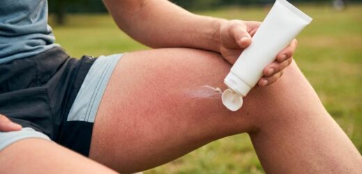 Person applying anti chafing balm on inner thighs before running